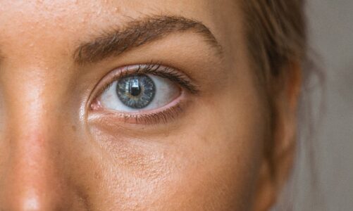 5 trików na redukcję cieni pod oczami